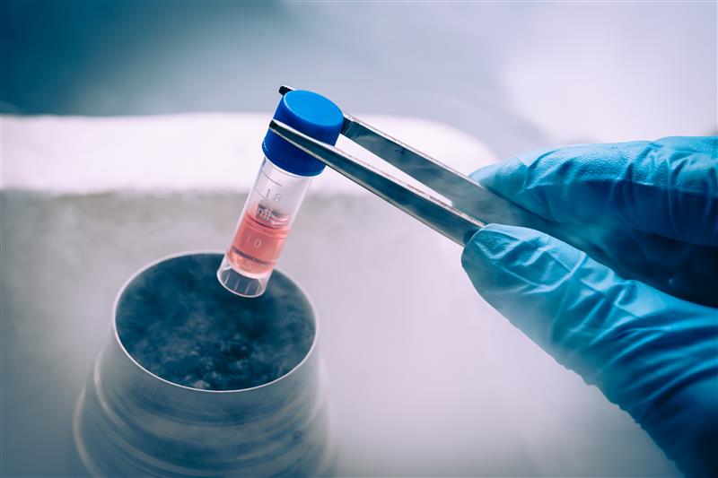 Cell and gene therapy cryogenic vial